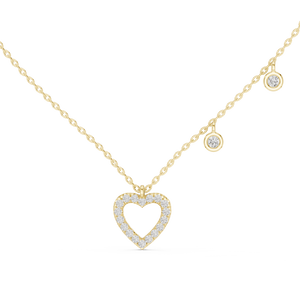 KM0146 Yellow Gold View 4